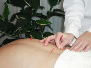 Gentle Acupuncture