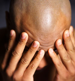 migraine headache