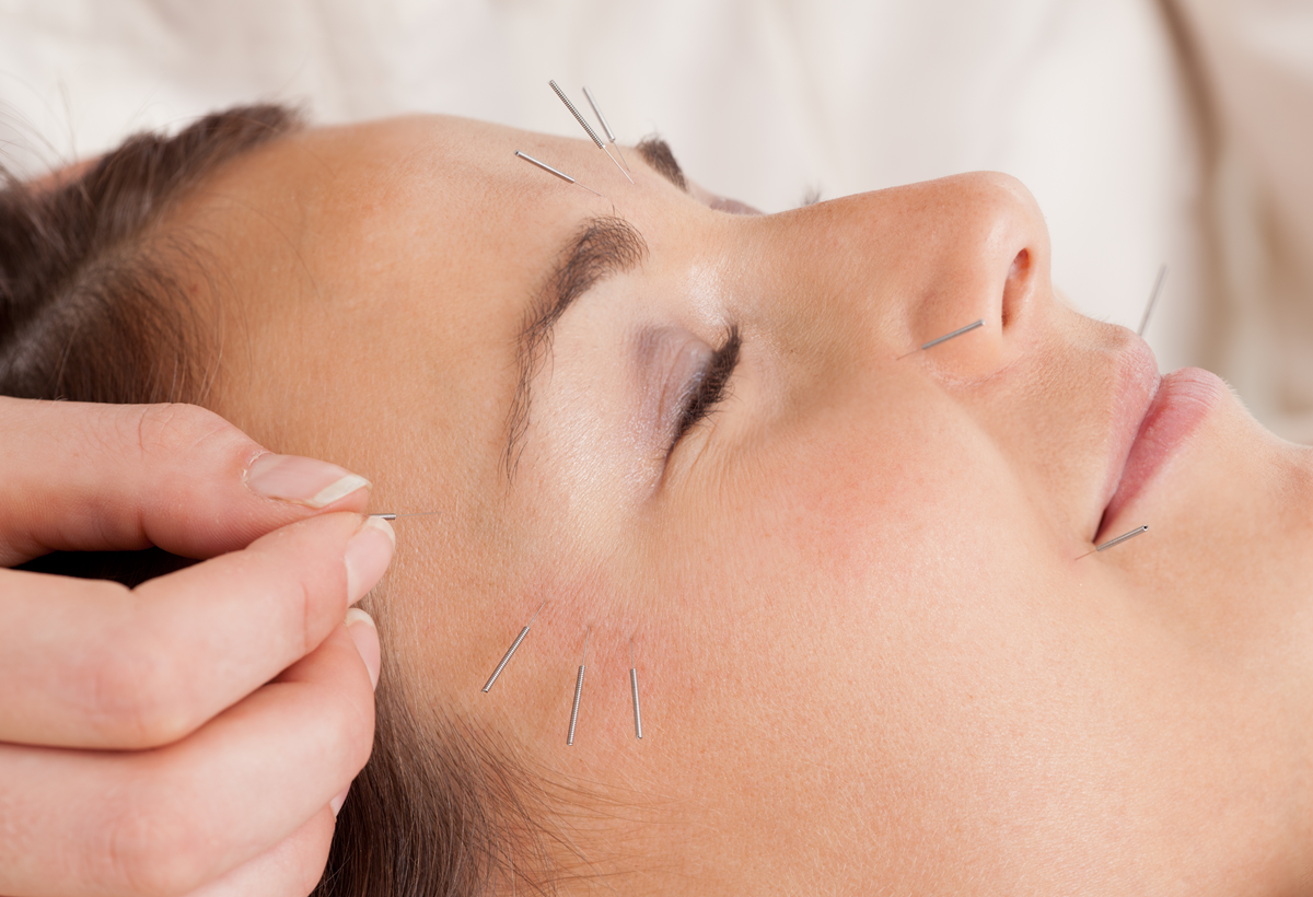 Women Facial microneedling
